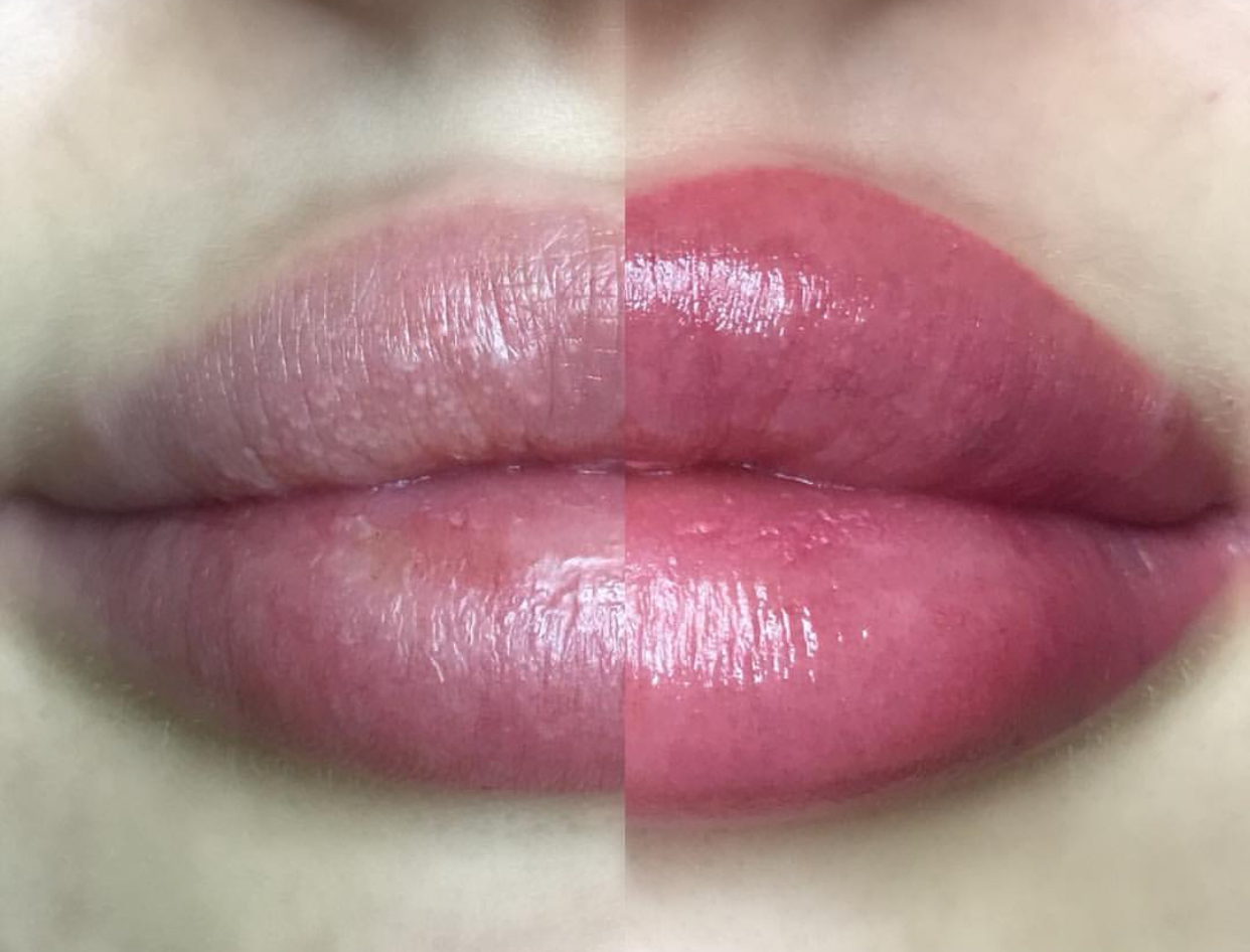 Lippigmentatie Full Lips Permanent